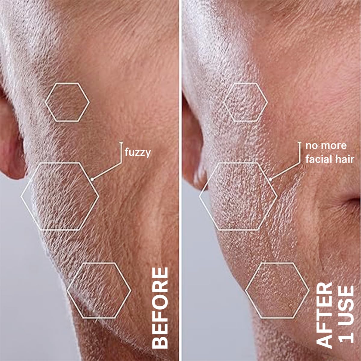 Michael Todd Beauty Sonicsmooth Dermaplane Razor for Women Face + Eyebrow trimmer Dermaplaning System - Peach Fuzz Remover - 8 Weeks of Dermaplaning Blades, Pink8